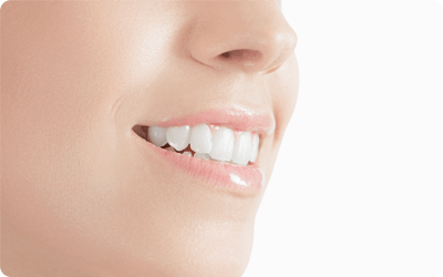 セラミックは虫歯の再発リスクを少なくします