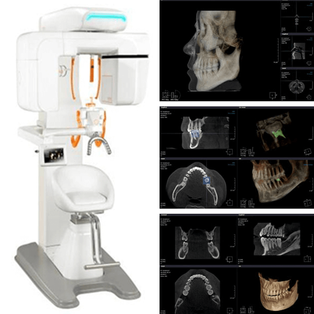 院内の歯科用CT