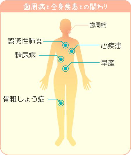 歯周病と全身疾患の関連性